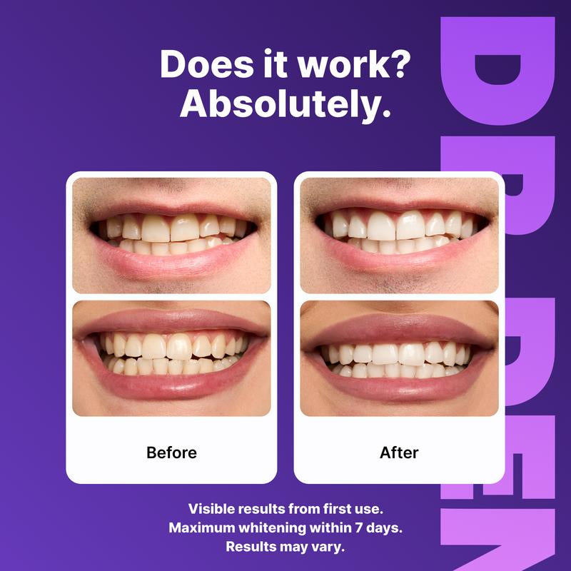 New Smile Purple Teeth Whitening Strips Peroxide-Free • Enamel-Safe • Gentle Formula
